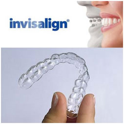 Invisalign